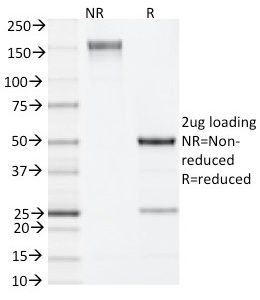 SDS-PAGE Analysis of Purified IL-4 Rat Monoclonal Antibody (11B11). Confirmation of Integrity and Purity of Antibody.