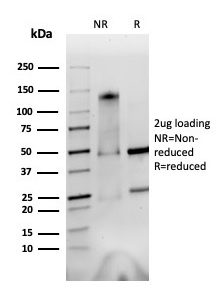 SDS-PAGE Analysis of Purified CD51 / Integrin ?V Rat Monoclonal Antibody (AvB6 53a.2). Confirmation of Purity and Integrity of Antibody.