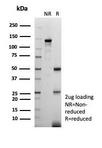 EGFR Antibody in SDS-PAGE.