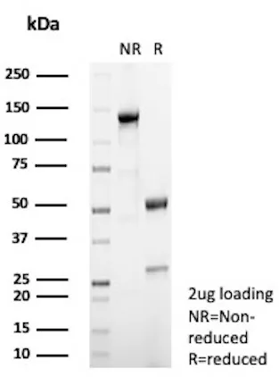 SF1 Antibody in SDS-PAGE.