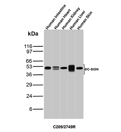 Western blot analysis of Human Intestine, Human Heart, Human Kidney, Human Liver, and Human Skin tissue lysates using DC-SIGN Recombinant Rabbit Monoclonal
Antibody (C209/2749R). DC-SIGN Antibody in Western Blot (WB)