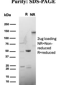 HLA-DRB Antibody in SDS-PAGE