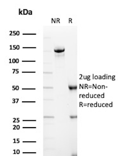 SDS-PAGE Analysis of Purified IGHM Mouse Recombinant Monoclonal Antibody (IrIGHM/2558). Confirmation of Purity and Integrity of Antibody. IGHM Antibody in SDS-PAGE