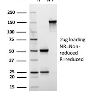 CD171 Antibody in SDS-PAGE