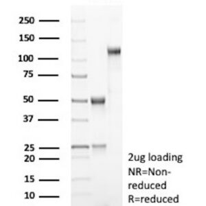 CD171 Antibody in SDS-PAGE