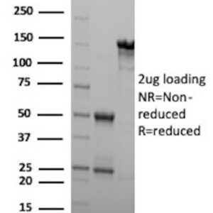 PSAP Antibody in SDS-PAGE