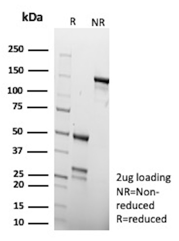 SDS-PAGE Analysis of Purified BCL2-like-2 Mouse Monoclonal Antibody (CPTC-BCL2L2-2). Confirmation of Purity and Integrity of Antibody. BCL2-like-2 Antibody in SDS-PAGE
