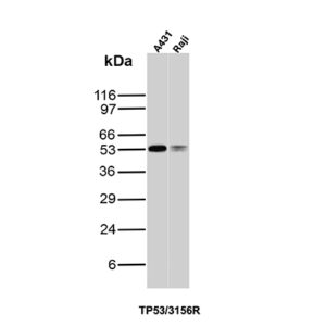 TP53 Antibody in Western Blot (WB)