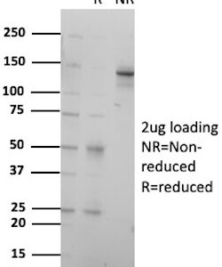 TSH Receptor Antibody in SDS-PAGE