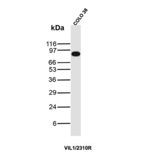 Villin Antibody in Western Blot (WB)