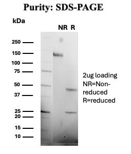 CD1a Antibody in SDS-PAGE