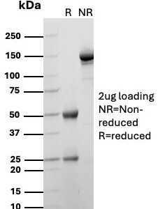 CD4 Antibody in SDS-PAGE