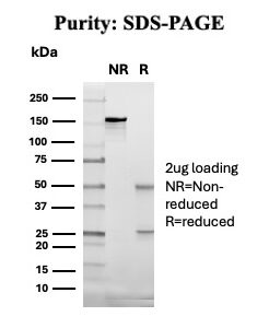 CD14 Antibody in SDS-PAGE