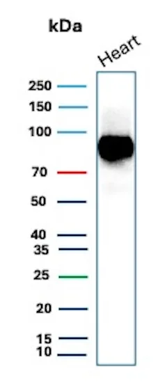 Western Blot Analysis of human heart tissue lysate using CD36 Mouse Monoclonal Antibody (CD36/7217). CD36 Antibody in Western Blot (WB)