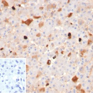 APOA1 Antibody in Immunohistochemistry (IHC (P))