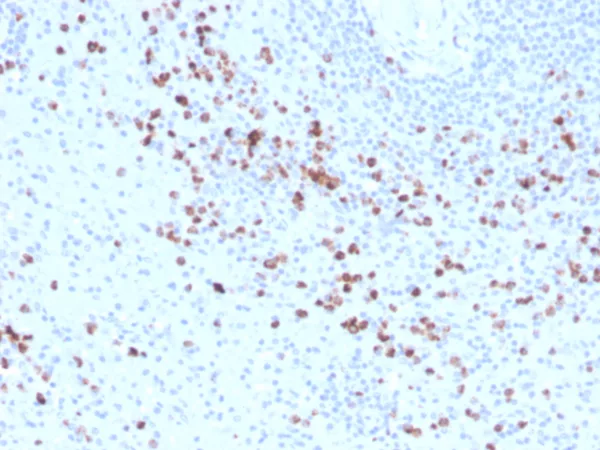 Biotinylated Granzyme B Antibody in Immunohistochemistry (IHC (P)).