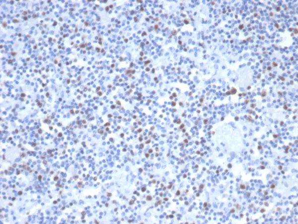 MSH6 Antibody in Immunohistochemistry (IHC (P))