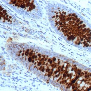TAG-72 / CA72.4 (Tumor-Associated Glycoprotein) Antibody