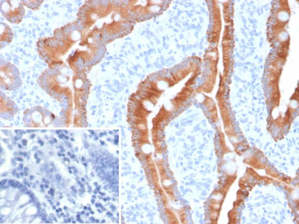 Formalin-fixed, paraffin-embedded human colon stained with
KRT8/18 Recombinant Rabbit Monoclonal Antibody (KRT8.18/6579R).
Inset: PBS instead of primary antibody; secondary only negative control.