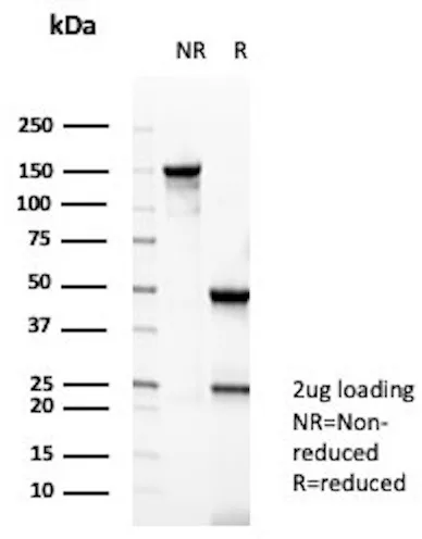 CKBB Antibody in SDS-PAGE.