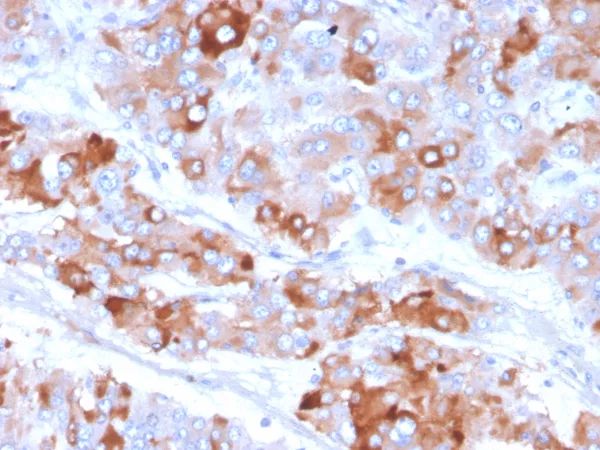 Clusterin Antibody in Immunohistochemistry (IHC (P)).