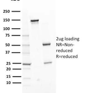 ERCC1 Antibody in SDS-PAGE.