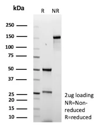 Fibroblast Activation Protein alpha Antibody in SDS-PAGE.