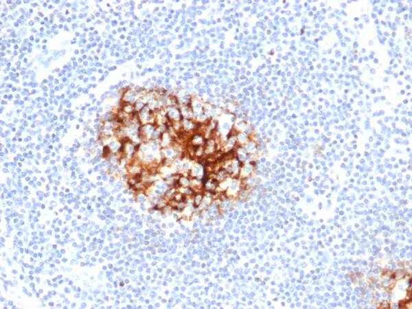 CD23 Antibody in Immunohistochemistry (IHC (P)).