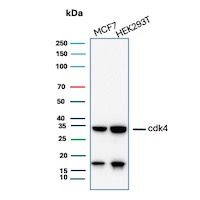 Western blot analysis of MCF7 and HEK293T cell lysates using CDK4 Recombinant Rabbit Monoclonal Antibody (CDK4/8210R). CDK4 Antibody in Western Blot (WB)