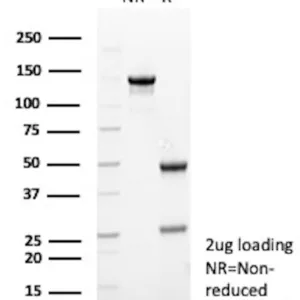 TUBB3 Antibody in SDS PAGE