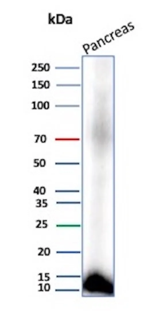 Colipase / CLPS Antibody in Western Blot (WB)