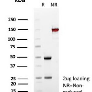 CD35 Antibody in SDS-PAGE
