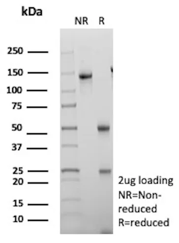 S100A16 Antibody in SDS PAGE