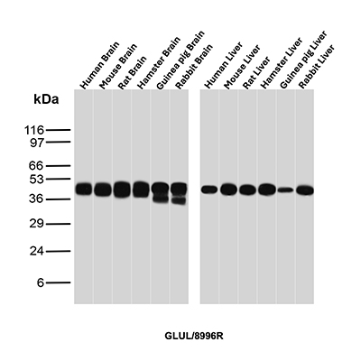 Western Blot analysis of Human Brain, Mouse Brain, Rat Brain, Hamster Brain, Guinea pig Brain, Rabbit Brain, Human Liver, Mouse Liver, Rat Liver, Hamster Liver, Guinea pig Liver, and Rabbit Liver tissue lysates using GLUL Recombinant Rabbit Monoclonal Antibody (GLUL/8996R). GLUL Antibody in Western Blot (WB)