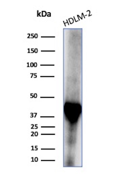 Western Blot Analysis of HDLM-2 lysate using STING1 Mouse Monoclonal Antibody (STING1/7439). STING1 Antibody in in Western Blot (WB)