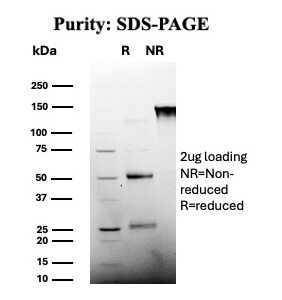 CD25 Antibody in SDS-PAGE