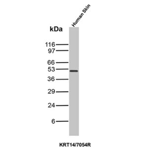 Cytokeratin 14 Antibody in Western Blot(WB)