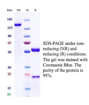 SDS-PAGE Analysis of Purified MCM2 Recombinant Rabbit Monoclonal Antibody (MCM2/12969R). Confirmation of Purity and Integrity of Antibody. MCM2 Antibody in SDS-PAGE