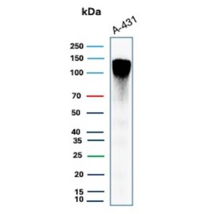 MCM2 Antibody in Western Blot (WB)