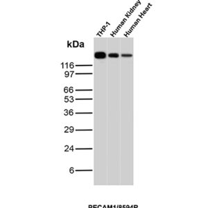 CD31 Antibody in Western Blot (WB)