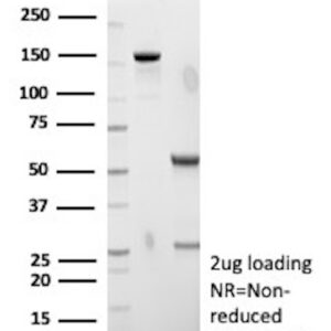 SSTR2 Antibody in SDS-PAGE