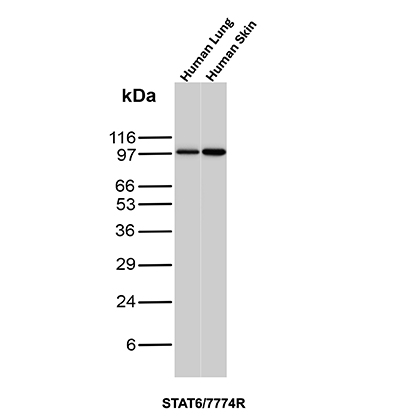 Western blot analysis of Human Lung and Human Skin tissue lysates using STAT6 Rabbit Recombinant Monoclonal Antibody (STAT6/7774R). STAT6 Antibody in Western Blot (WB)