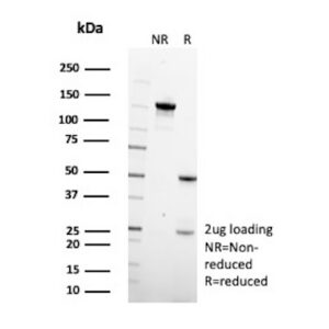 TGFB2 Antibody in SDS-PAGE