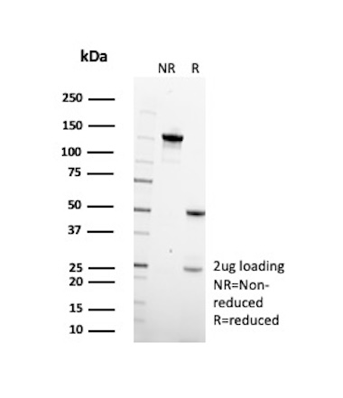 SDS-PAGE Analysis of Purified TGFB2 Mouse Monoclonal Antibody (TGFB2/1679). Confirmation of Purity and Integrity of Antibody. TGFB2 Antibody in SDS-PAGE