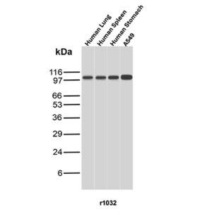 Major Vault Protein Antibody in Western Blot (WB)