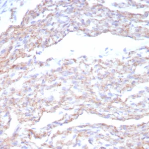 Formalin-fixed, paraffin-embedded human heart stained with N-Cadherin Recombinant Rabbit Monoclonal Antibody (CDH2/8815R). HIER: Tris/EDTA, pH9.0, 45min. 2°C: HRP-polymer, 30min. DAB, 5min.