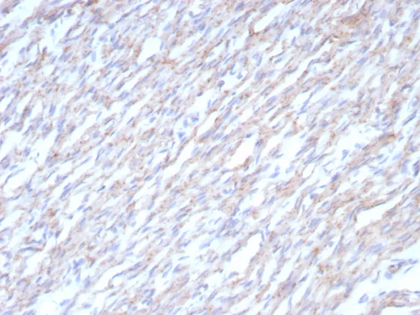 Formalin-fixed, paraffin-embedded human heart stained with N-Cadherin Recombinant Rabbit Monoclonal Antibody (CDH2/8862R). HIER: Tris/EDTA, pH9.0, 45min. 2°C: HRP-polymer, 30min. DAB, 5min.