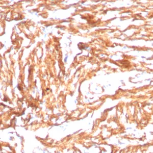 Formalin-fixed, paraffin-embedded human heart stained with N-Cadherin Recombinant Rabbit Monoclonal Antibody (CDH2/8998R). HIER: Tris/EDTA, pH9.0, 45min. 2°C: HRP-polymer, 30min. DAB, 5min.