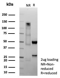 SDS-PAGE Analysis of Purified CDH6 Recombinant Rabbit Monoclonal Antibody (CDH6/9300R). Confirmation of Purity and Integrity of Antibody.