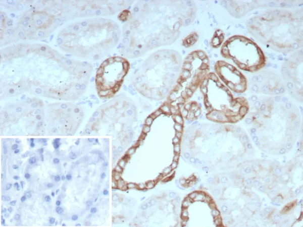 Formalin-fixed, paraffin-embedded human kidney stained with Occludin Recombinant Mouse Monoclonal Antibody (rOCLN/8776). Inset: PBS instead of primary antibody; secondary only negative control.